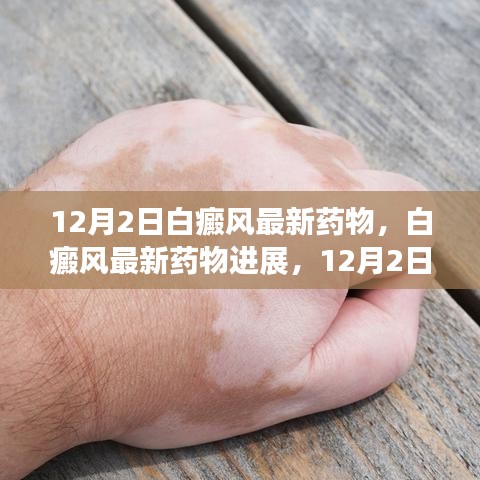 白癜风最新药物进展解读，12月更新报告