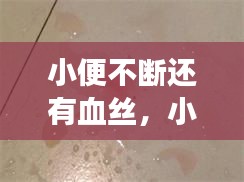 小便不断还有血丝，小便一直带血怎么回事 