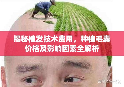 揭秘植发技术费用，种植毛囊价格及影响因素全解析